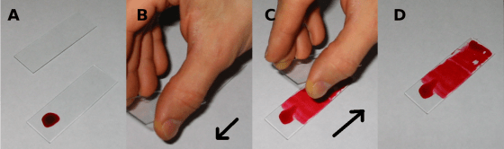 Practice the method with ink before working with blood.