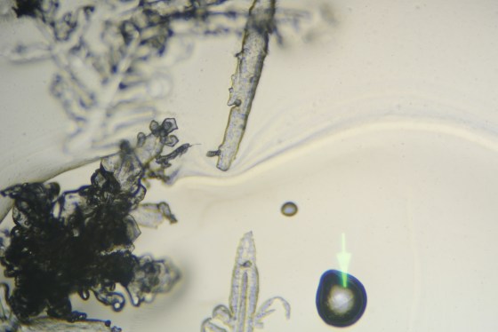 Our condenser properly aligned provides axial lighting.