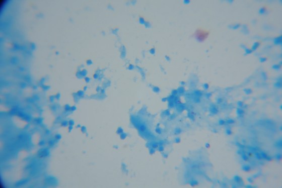 Critical illumination at high magnification.