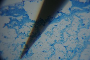 Image of focusing assist in image plane of specimen.