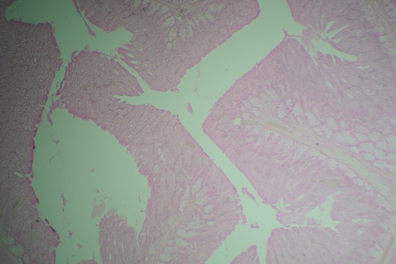 At low power (10x Plan-Achro objective) with the BalPlan.