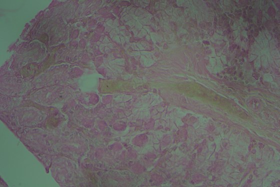 High-dry (43x Plan-Achro objective) with the BalPlan.