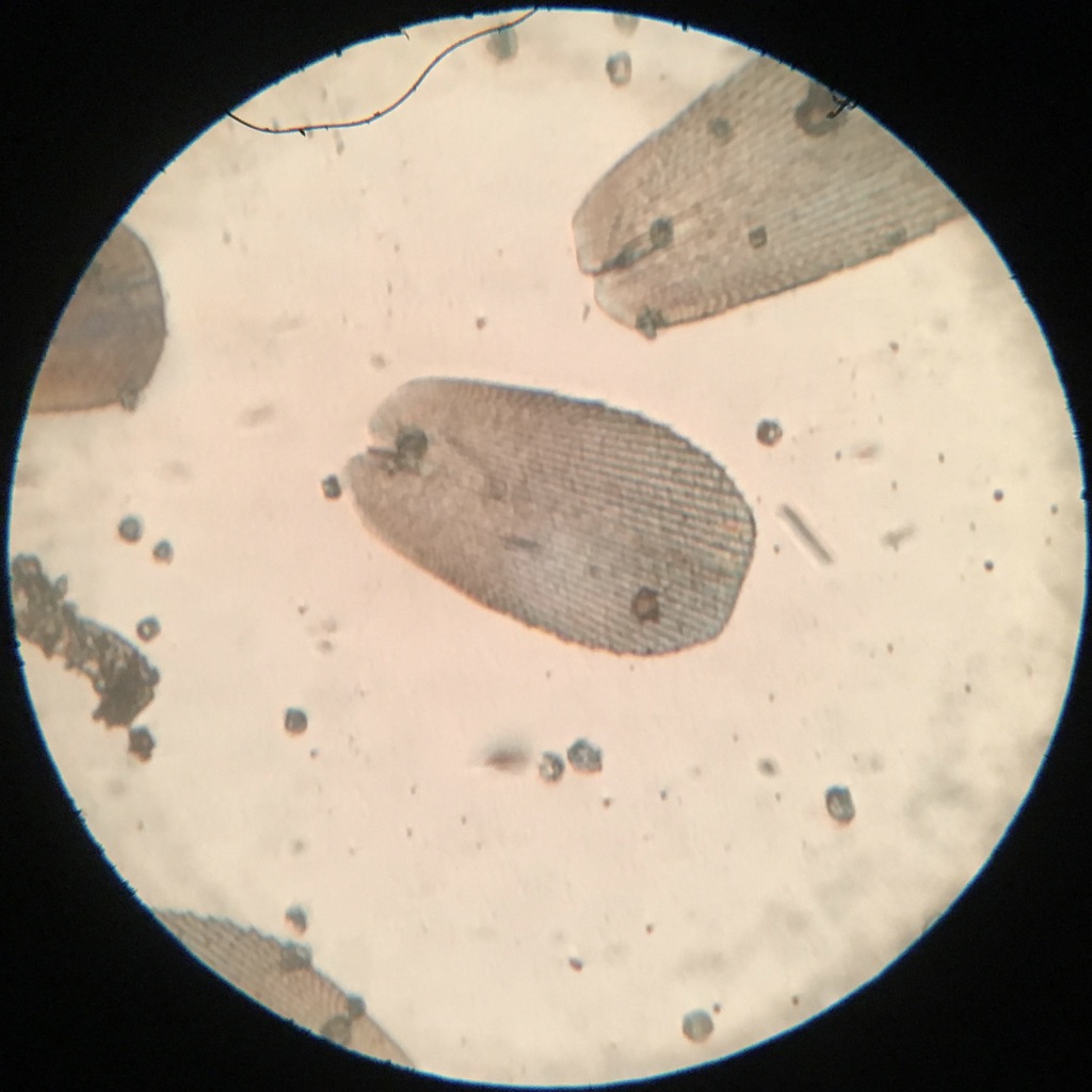 Model R Podura scale at 300x