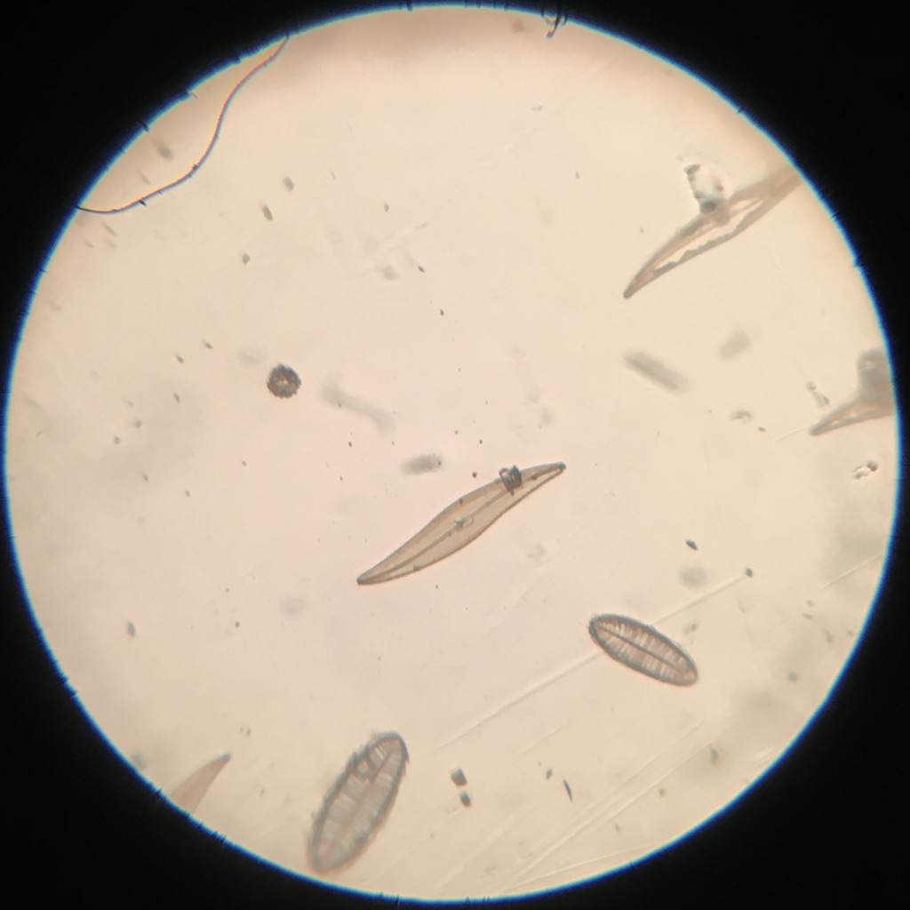 Model R Plerosigma angulatum 75x