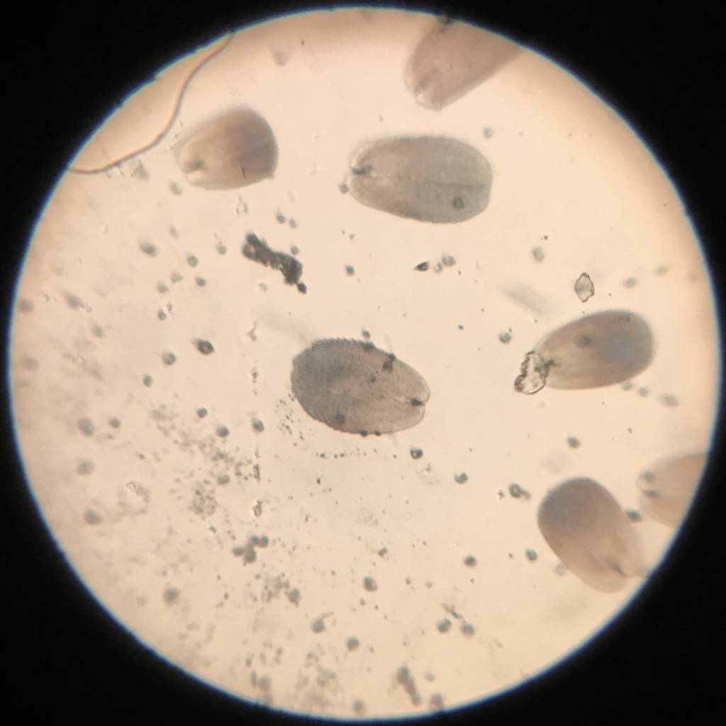 Model R Podura scale at 75x